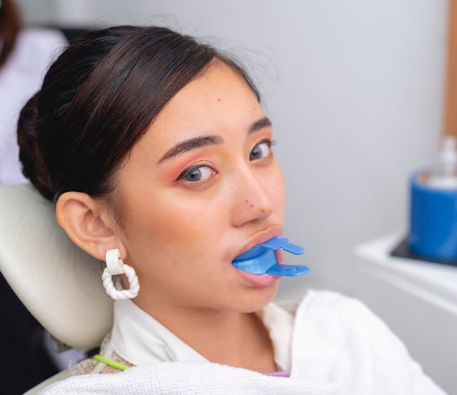 Woman in dental chair with fluoride trays over teeth