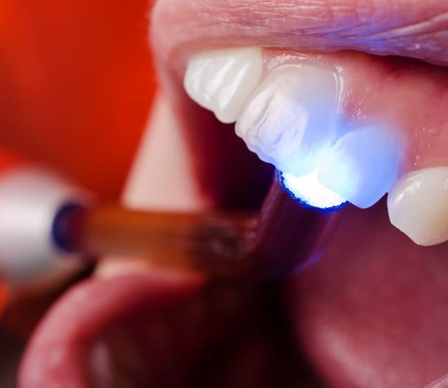 Patient receiving cosmetic dental bonding