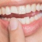 Closeup of patient with chipped front tooth