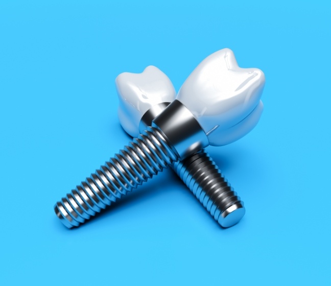 Two animated dental implants