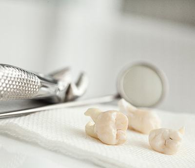 Dental tools next to clean teeth on napkin