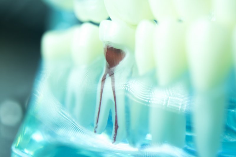Model of root canal
