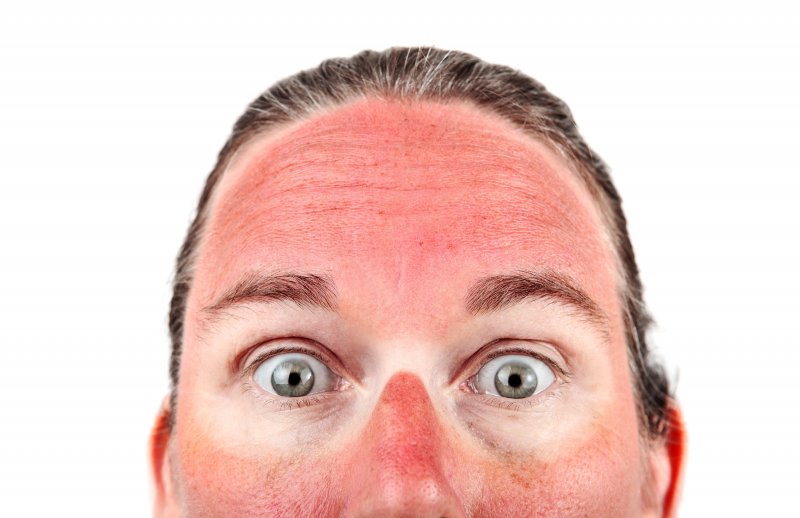 closeup of someone who’s been sunburned