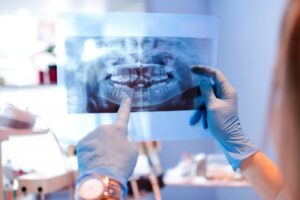 Dental X-ray.